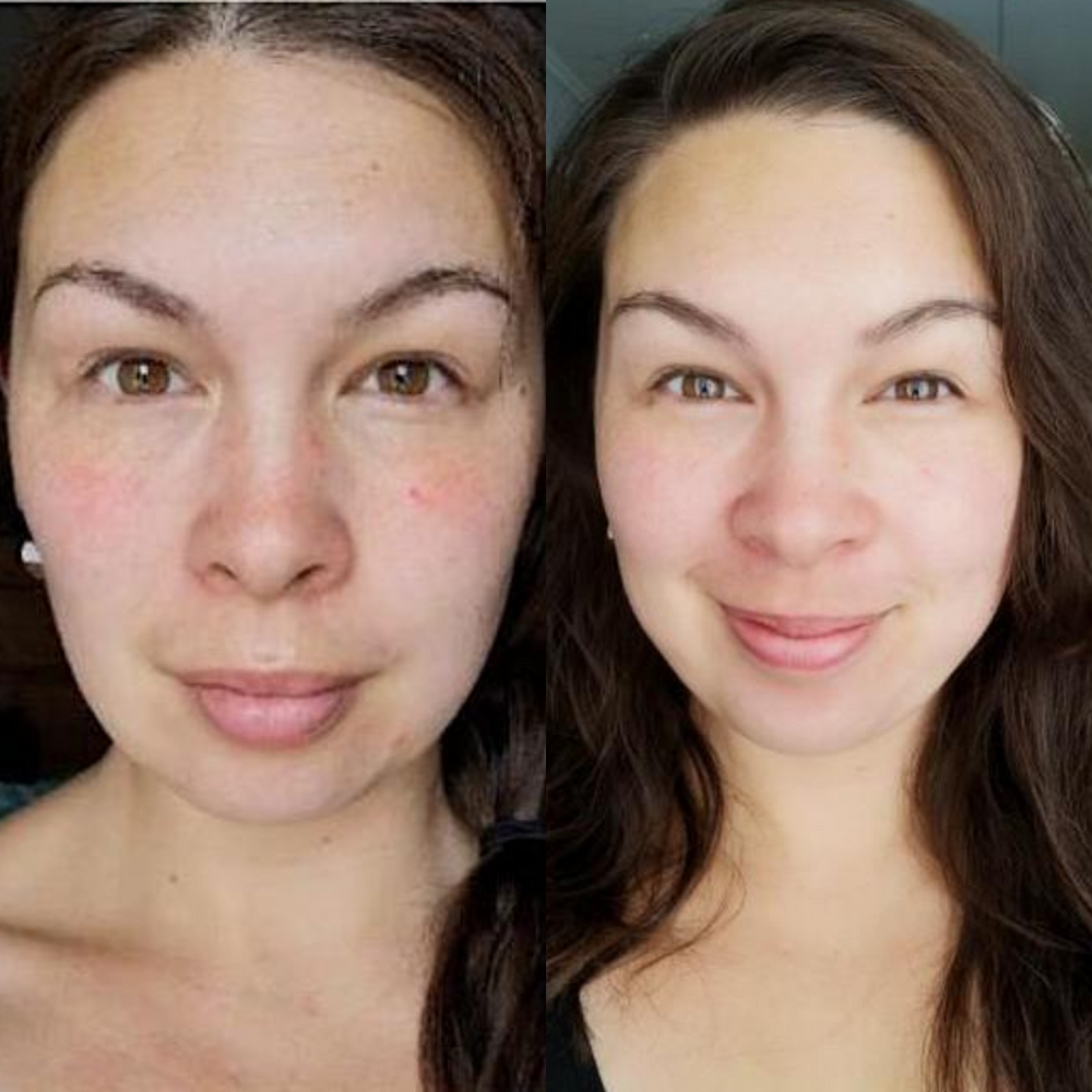 kincare_daily_essentials_pack_before_after
